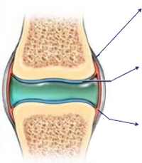 Damaged Knee Joint